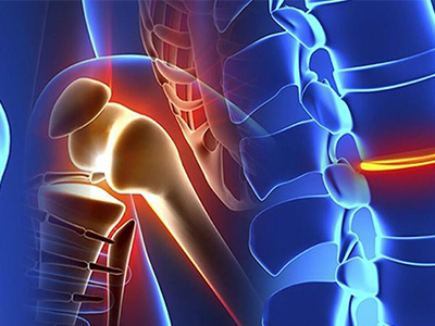 Orthopaedic Trauma